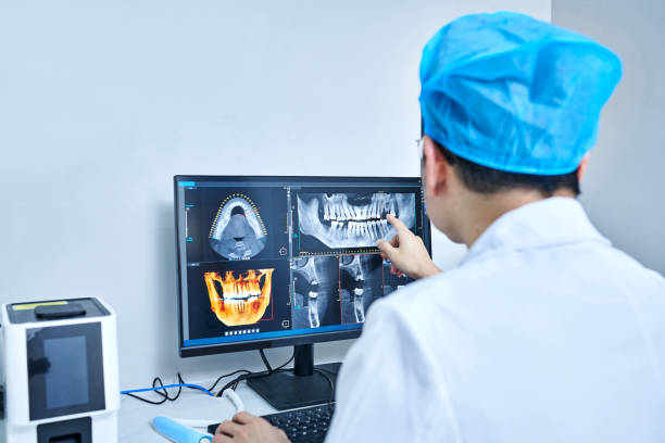 Best Knocked-Out Tooth (Avulsed Tooth) Treatment in Hopwood, PA