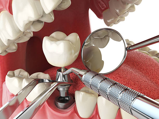 Best Broken or Chipped Tooth Repair in Hopwood, PA